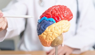 Cerebro