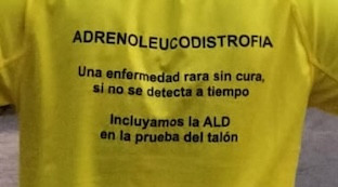 Enfermedad infantil cribado